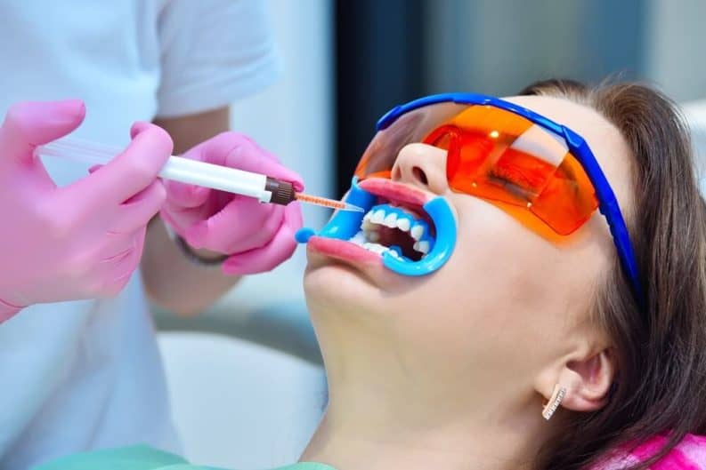 Get a brighter smile in minutes with instant results whitening Bolton