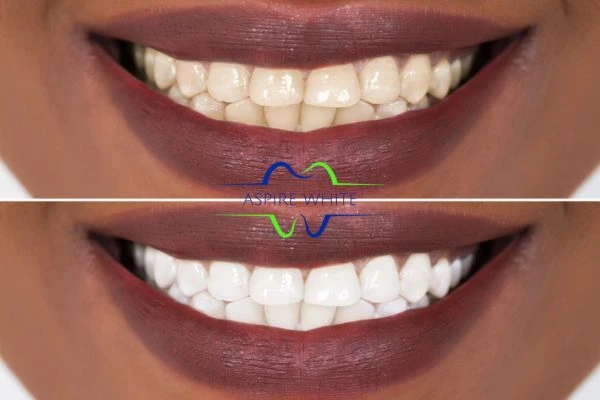 Side-by-side comparison showing before and after results of a cosmetic treatment Bolton