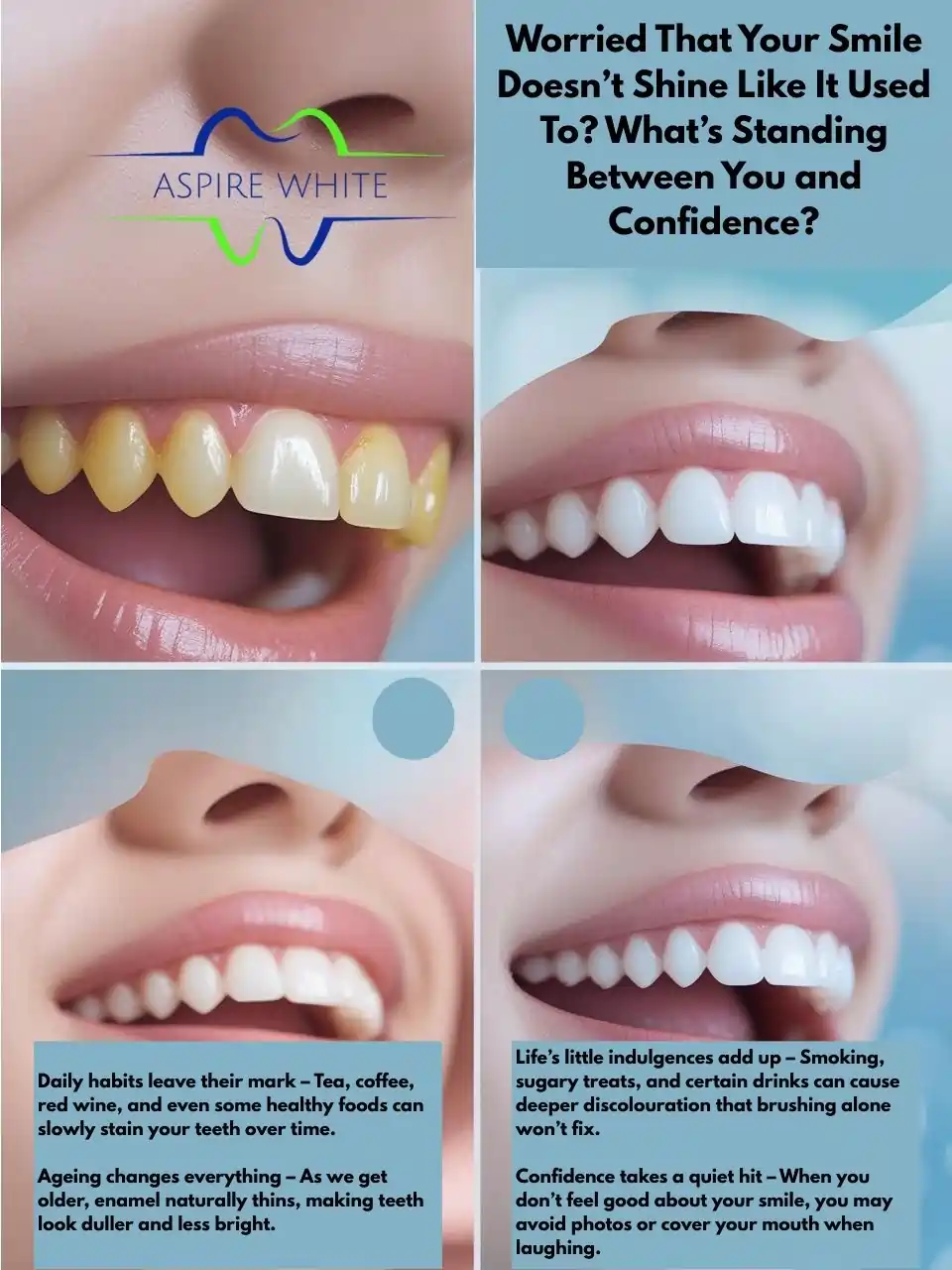 Worried That Your Smile Doesn’t Shine Like It Used To What’s Standing Between You and Confidence Bolton